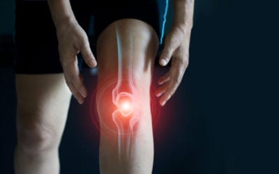 When to Consider Knee Surgery
